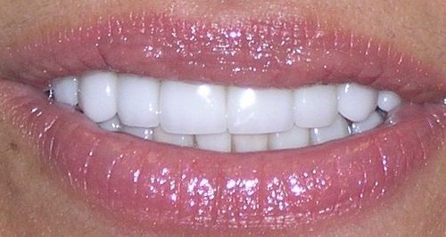 A close up of a woman 's mouth with white teeth.