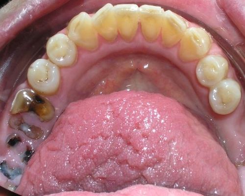 A close up of a person 's mouth with a lot of teeth