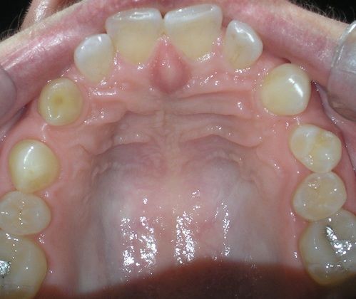 A close up of a person 's mouth showing their teeth