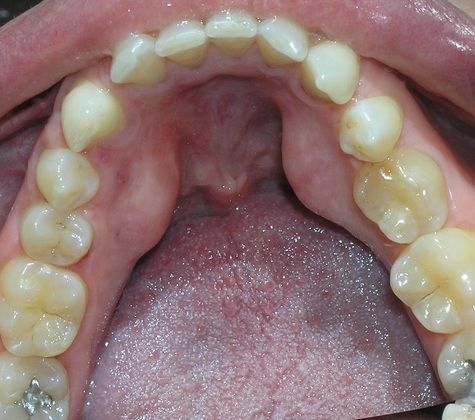 A close up of a person 's mouth showing their teeth