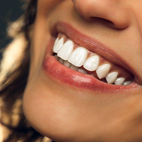 Close-up of a smiling person's mouth, showing white teeth and pink lips.