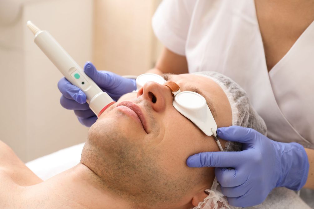 seduta di crioterapia