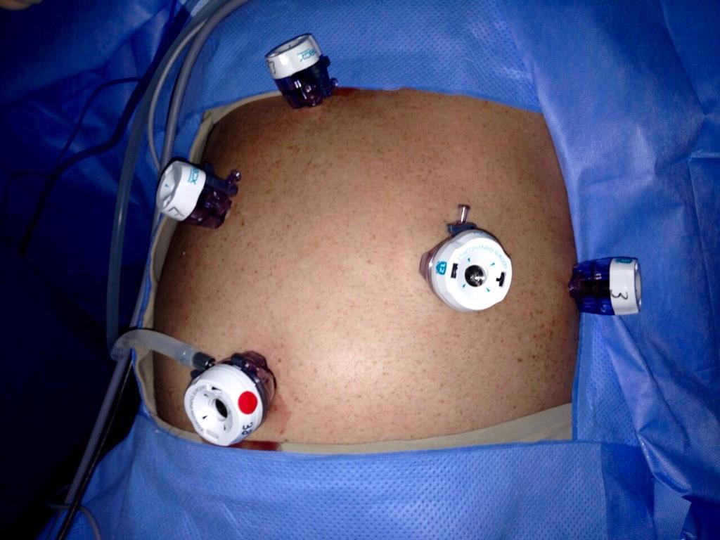 Una persona está siendo operada por un cirujano en un quirófano.