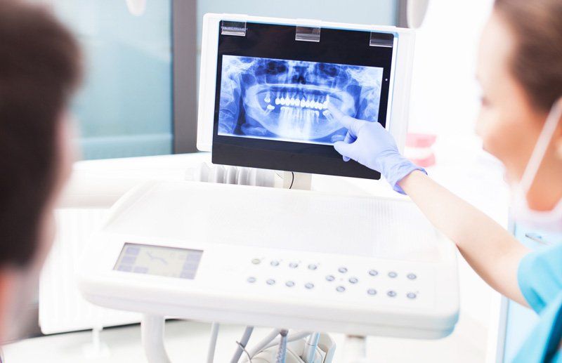 Looking At Digital X-rays — Bismarck, ND — A Lifetime of Smiles Looking At Digital X-rays — Bismarck, ND — A Lifetime of Smiles