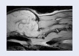 MRI scan image