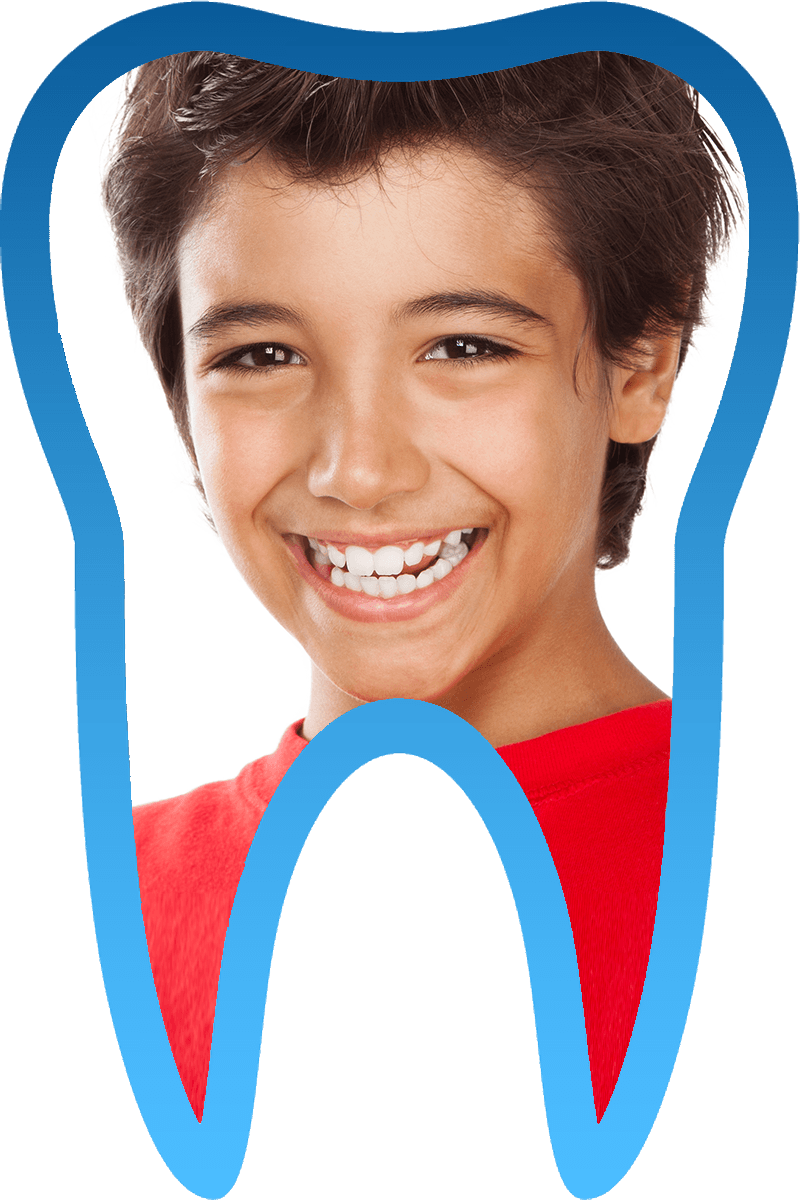 White fillings