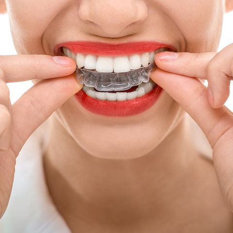 Perfect teeth
