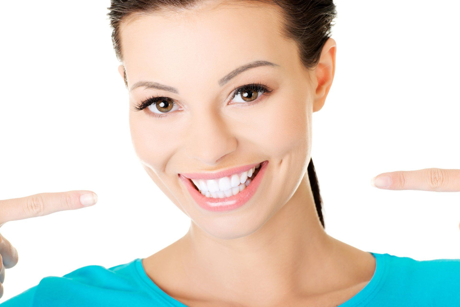Veneers