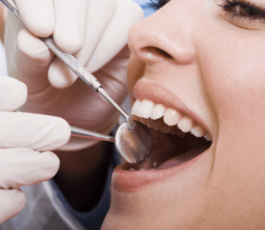 pulizia dentale pulizia dentale