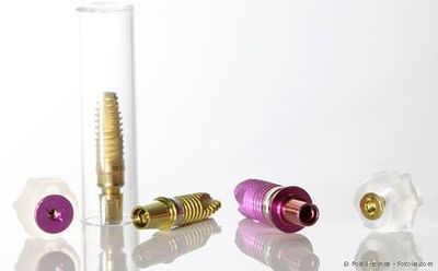 Was sind Zahnimplantate und woraus bestehen sie? Wie werden Implantate gesetzt? Was sind Zahnimplantate und woraus bestehen sie? Wie werden Implantate gesetzt?