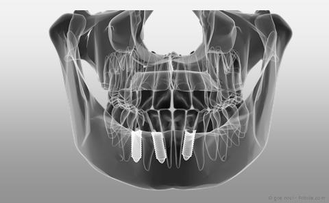 © goa novi - Fotolia.com