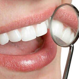 Woman Smiling with Dental Mirror - Dentist in Carneys Point, NJ Woman Smiling with Dental Mirror - Dentist in Carneys Point, NJ