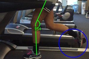 Patient Running On The Treadmill — Murrysville, PA — Alliance Physical Therapy Expert sports therapy services near Pittsburgh, PA