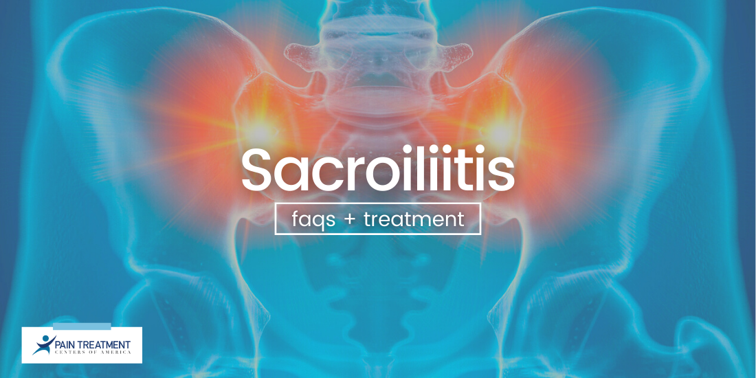Sacroiliitis FAQs blog graphic Sacroiliitis FAQs blog graphic