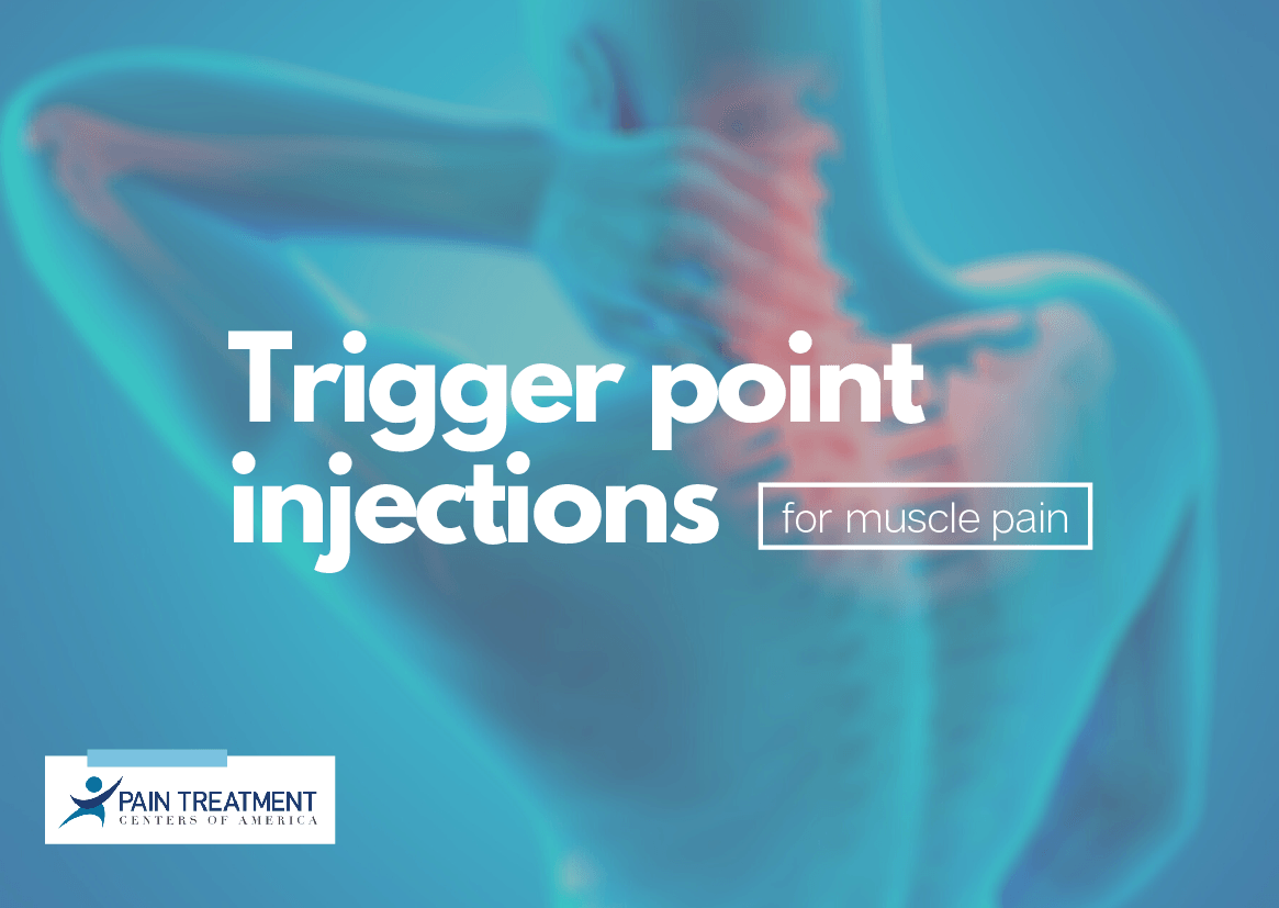 Trigger Point Injections Graphic Trigger Point Injections Graphic