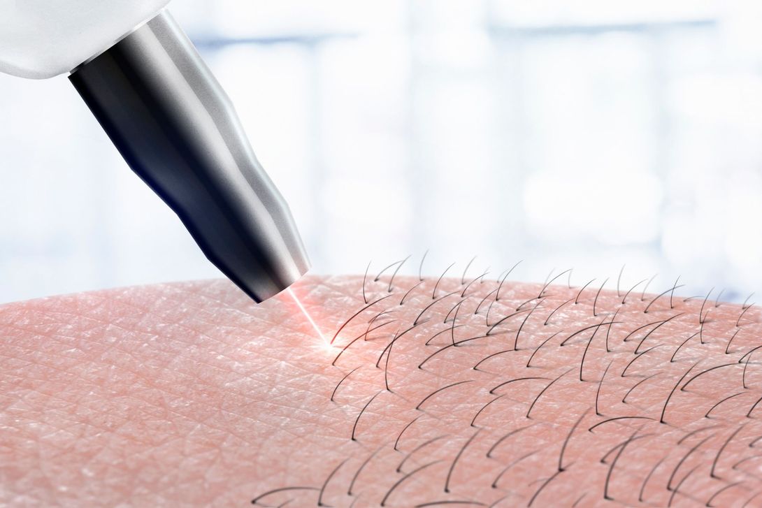 Luce pulsata