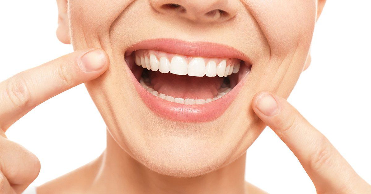 invisalign