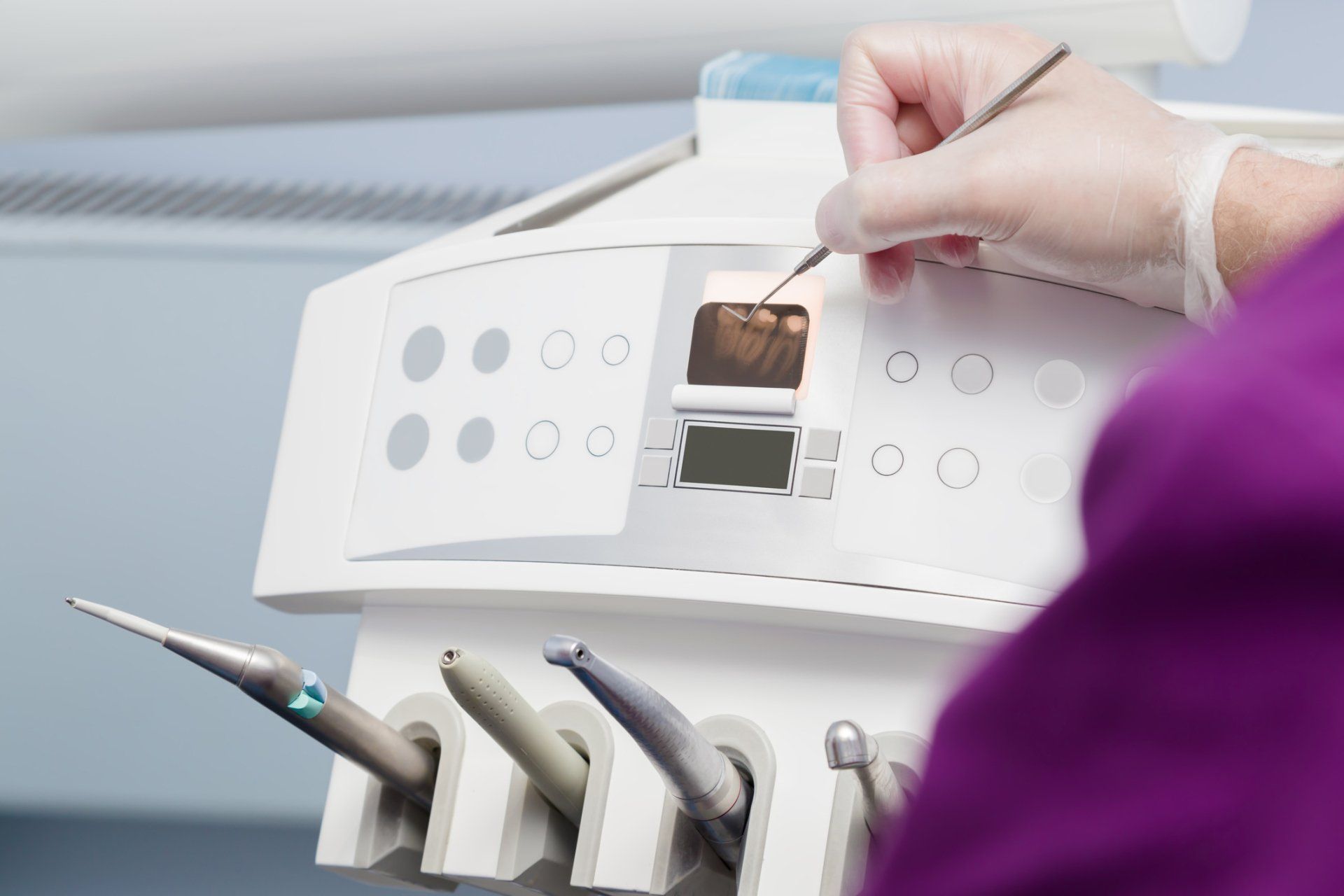 Using Tooth Scale Sample — Palmdale, CA — Posada Dental Practice Using Tooth Scale Sample — Palmdale, CA — Posada Dental Practice