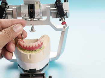Dental Implant — Palmdale, CA — Posada Dental Practice Dental Implant — Palmdale, CA — Posada Dental Practice