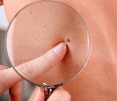 problemi della pelle, visite dermatologiche, dermatologia pediatrica