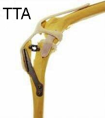 TTA example