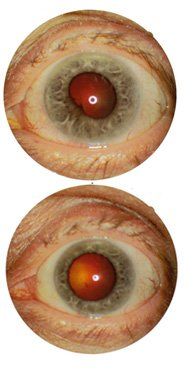 eye
