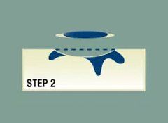 Step 2 Step 2