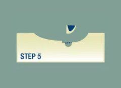 Step 5 Step 5