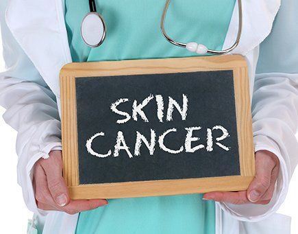 Mohs Surgery — Doctor Holding Skin Cancer Signboard in Greenville, SC Mohs Surgery — Doctor Holding Skin Cancer Signboard in Greenville, SC