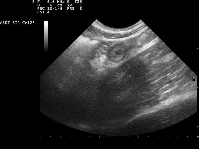 ultrasound