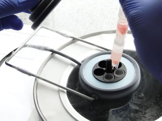 Factors that have a bearing on freezing eggs in Thailand