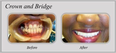 smile gallery 1