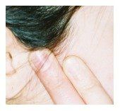 tmj treatment in Sanford