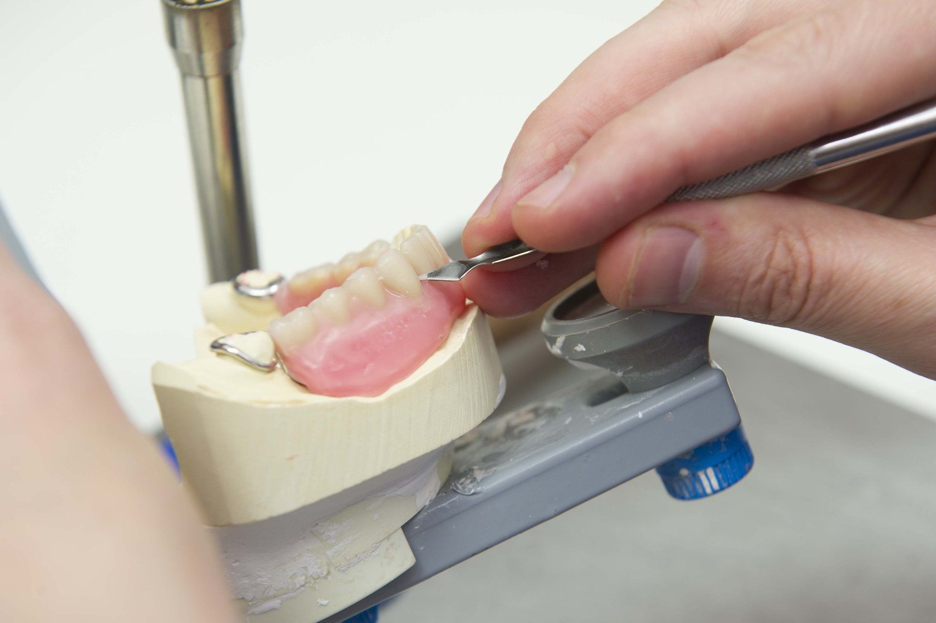 denture repairs