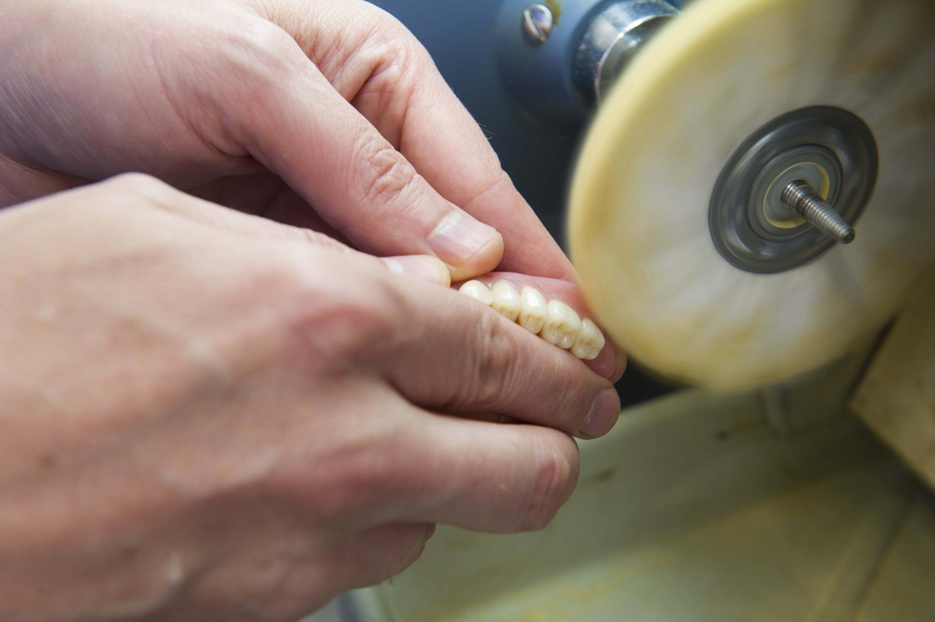 denture servicing