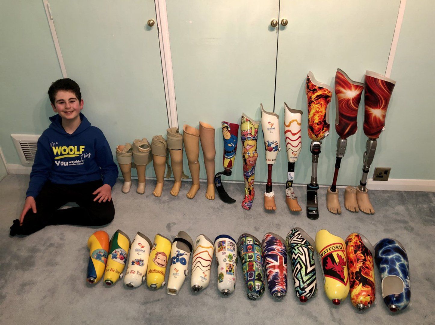 Prosthetics of Rio Woolf in time