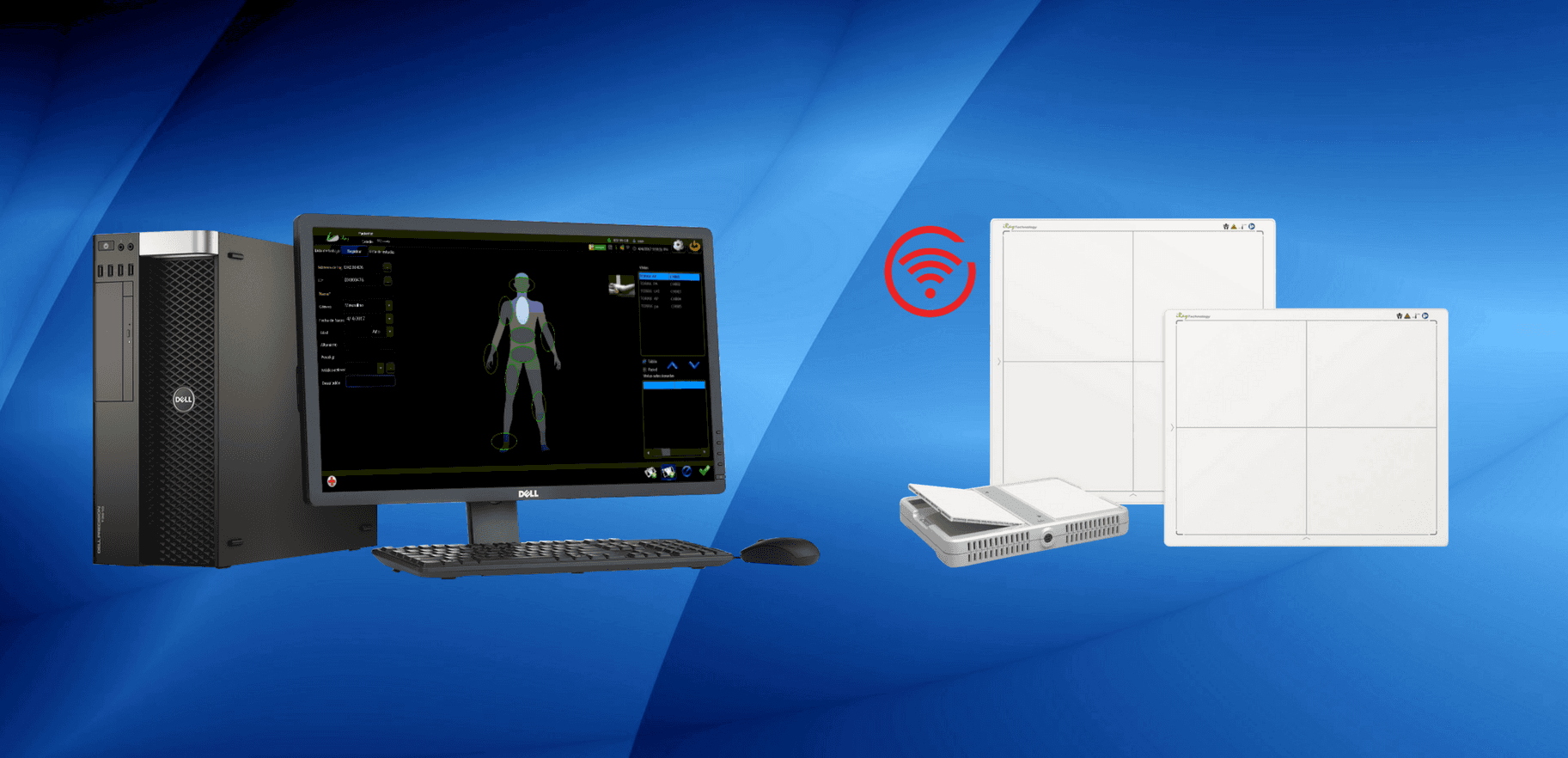 Medical Flat Panel Detectors.