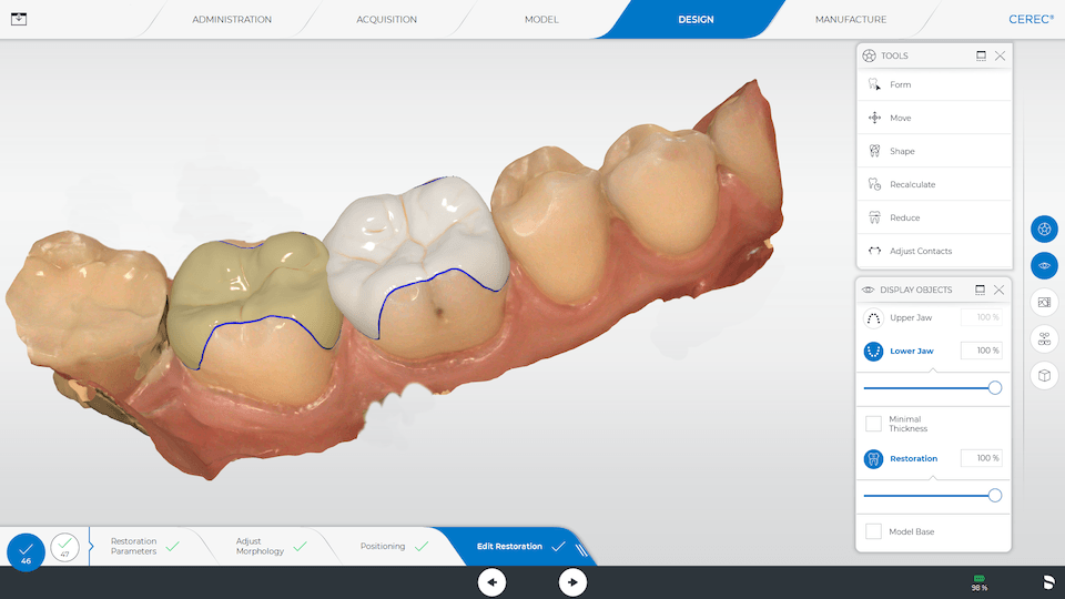 Screenshot Cerec