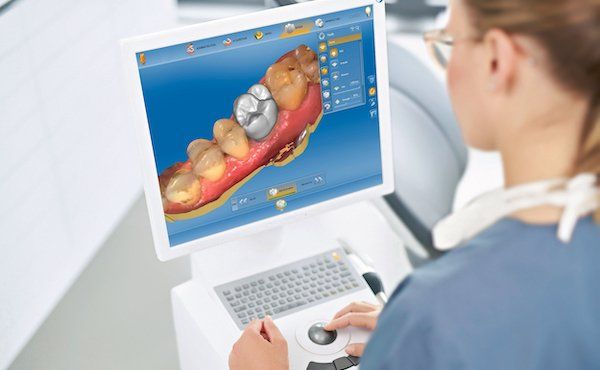Design einer Zahnkrone am Computer mit Cerec
