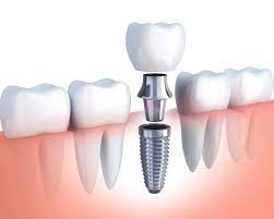 Senior Woman in the Dental Office — Mansfield, OH — Mark A. Massa, DDS, Inc. Senior Woman in the Dental Office — Mansfield, OH — Mark A. Massa, DDS, Inc.