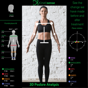 3D posture analysis screen with a person standing front-facing and posture markers, on black background