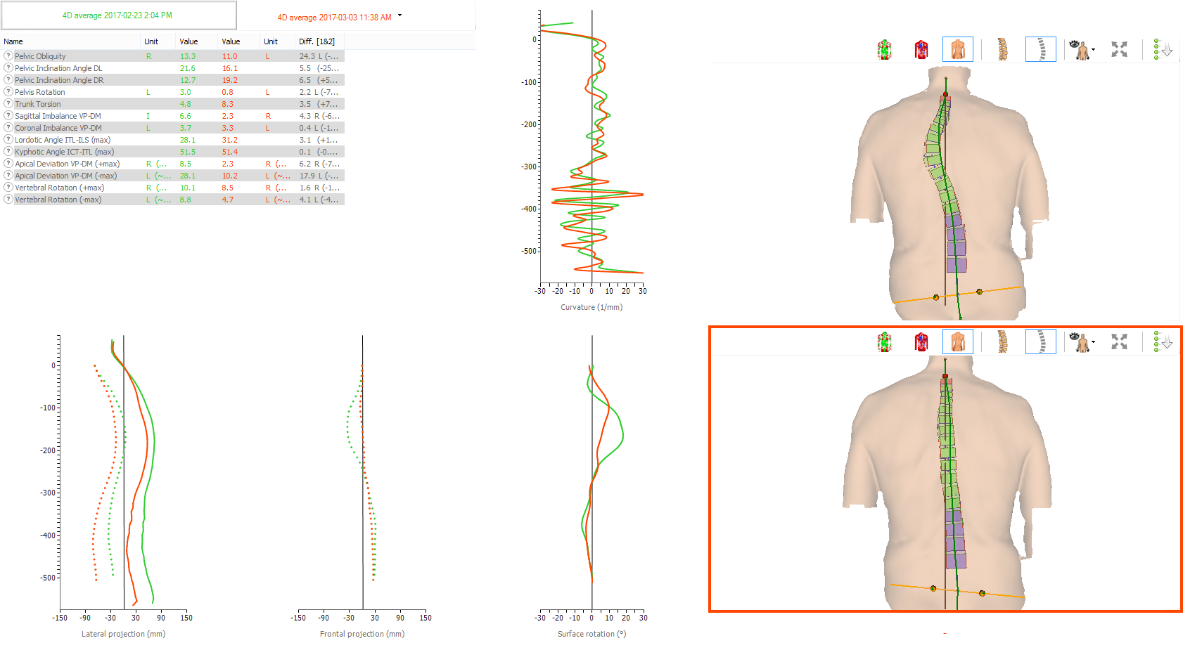 Medical report with charts and back scans showing spinal alignment and posture analysis results.