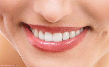 Veneers wurden in Hollywood erfunden Veneers wurden in Hollywood erfunden