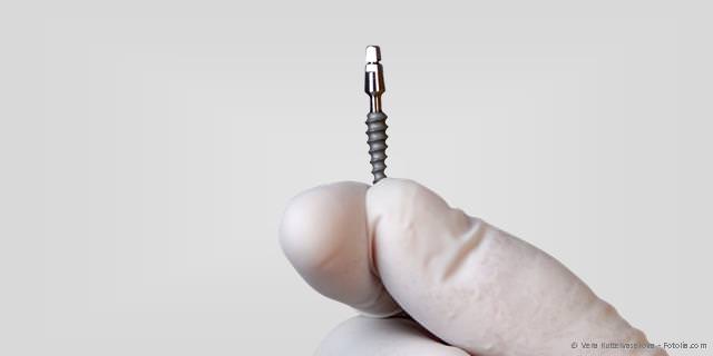 Minimalinvasive Implantation: Zierliche Implantate, die ohne Schneiden und Nähen eingesetzt werden. Minimalinvasive Implantation: Zierliche Implantate, die ohne Schneiden und Nähen eingesetzt werden.
