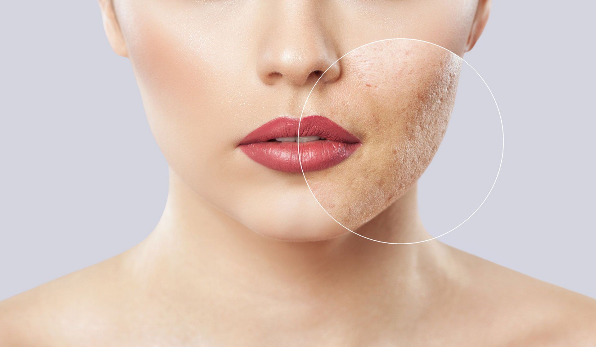 Skin Solutions — Columbus, OH — Encore Dermatology