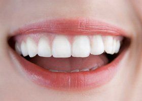 Dental practice - Romford, London - Oakland Dental Care - White teeth Dental practice - Romford, London - Oakland Dental Care - White teeth