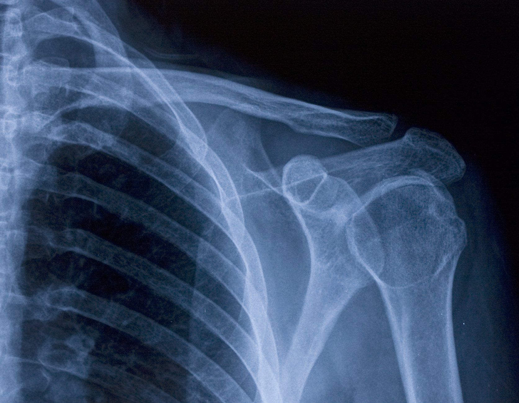 X-ray