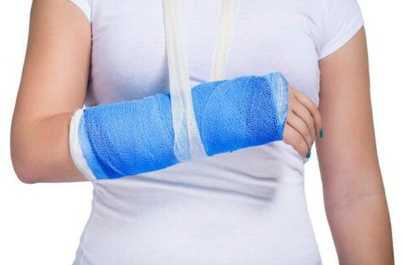 A woman with an injured arm — Jersey City, NJ — Pain and Disability Institute A woman with an injured arm — Jersey City, NJ — Pain and Disability Institute