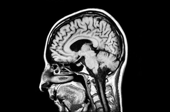 MRI scan — Jersey City, NJ — Pain and Disability Institute