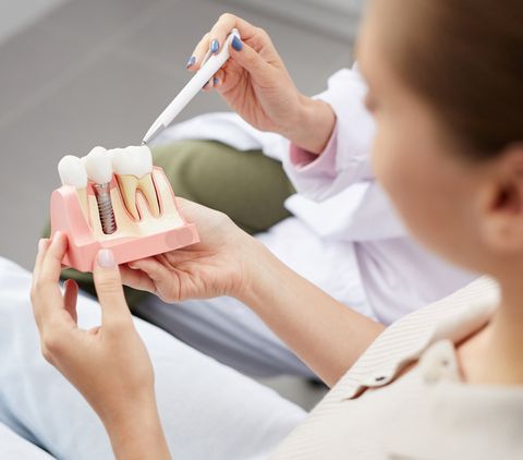 Explaining Tooth Implantation — Fort Myers, FL — Children & Adult Dentistry Explaining Tooth Implantation — Fort Myers, FL — Children & Adult Dentistry